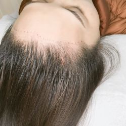 点击看大图 -AYA FACE 微注颜·德式半永久定妆