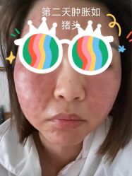 -海涛医疗美容·面部抗衰·注射美鼻