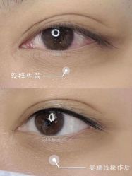 -久匠·纹眉纹绣半永久