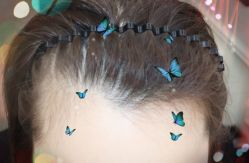 -大麦微针植发全国连锁