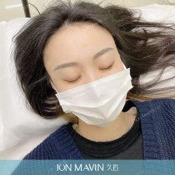 -久匠半永久纹眉