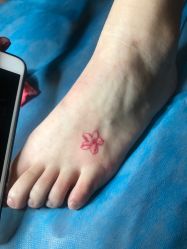 点击看大图 -新肤洗纹身