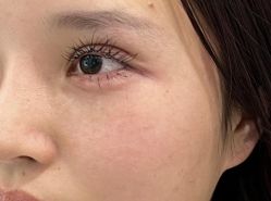 点击看大图 -杭州米兰柏羽医疗美容医院