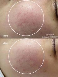 -E.beauty驻颜·痘敏肌调理中心