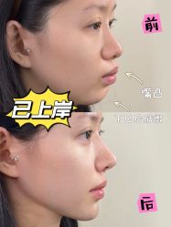 -深圳艺星医疗美容医院