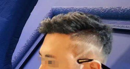 -大麦微针植发全国连锁