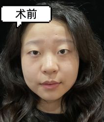 -素美医疗美容·西南眼鼻整形·修复基地