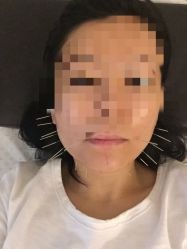 -肥三针腧穴瘦身馆