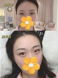 -UP&UP·半永久眉毛眼线机器野生眉