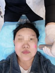 -More摩尔医美の注射线雕光电中心