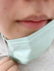 体验后-嘉和医学脱毛中心