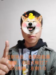 体验后-清华大学玉泉医院-医疗美容科