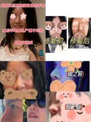 -四川米兰柏羽医学美容医院