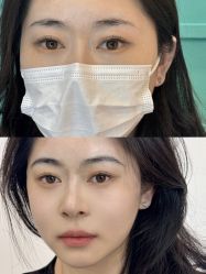 -杨益美学·野生眉半永久纹眉发际线