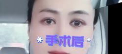体验后-八大处整形