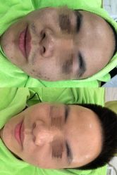 -苗医生草本科技祛痘