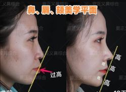-北京米扬丽格医疗美容·联合丽格鼻整形中心