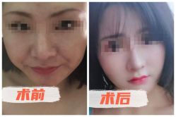 -素美医疗美容·西南眼鼻整形·修复基地