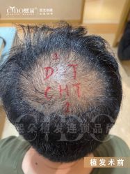 -熙朵美学植发·连锁品牌