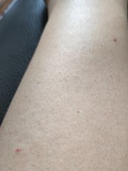 -丽美妍医疗美容·皮秒·立体分层抗衰