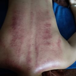 -御品•瑶浴灸疗SPA