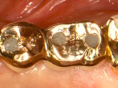 -精德口腔·种植修复·儿牙中心(财富中心店)