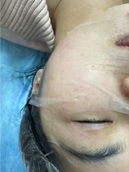 -长沙雅美医疗美容医院