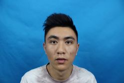 -安徽合肥韩美整形外科医院