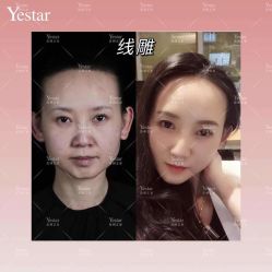 -Yestar艺星医疗美容医院