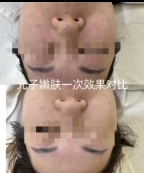 -LUNA皮相美·骨相美高级美感