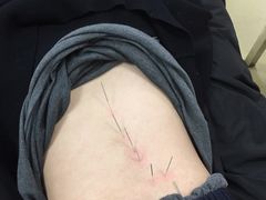 -上海市杨浦区中医医院