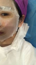 体验后-新美荟医美·专注面部美学抗衰