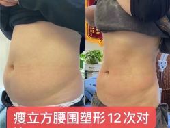 -瘦立方身材管理中心