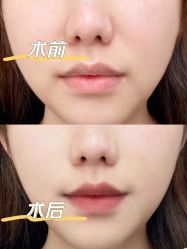 -深圳悦她医疗美容
