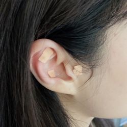-肥三针腧穴瘦身馆