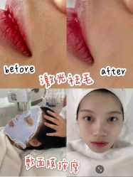 -skin79皮肤管理基站