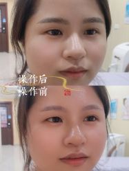 -西施无菌半永久纹绣眉眼影唇轻增发纹发际线