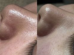 点击看大图 -栖SPA·ONDA ·海菲秀·皑皑科技美肤中心