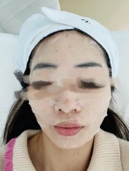 点击看大图 体验前-贞禾医美·连锁