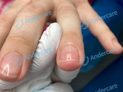 -Andrew指甲专科灰指甲·甲沟炎矫正·3D步态矫形鞋垫定制(浦三路店)
