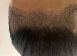 -雍禾植发全国连锁