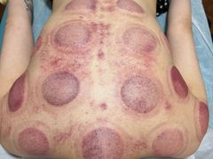 -刘超盲人按摩所(寇庄西路店)