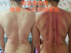 -丽减美瘦吧·减肥瘦身