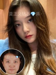 -北京米扬丽格医疗美容·联合丽格鼻整形中心