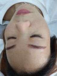 -悟空祛痘·专业祛痘机构