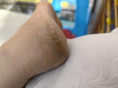 -郑远元专业修脚房(晴川街店)