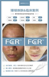 -苗方清颜痘肌研究所