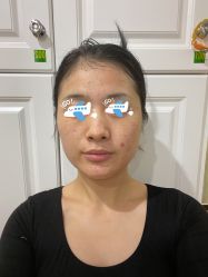 -新美荟医美·专注面部美学抗衰