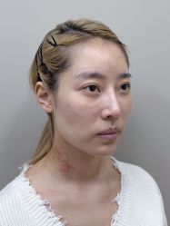 -深圳艺星医疗美容医院