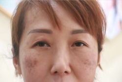 -万州华美紫馨整形美容医院